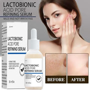 Lactobionic Acid Pore Refining Serum 30ML (Pack of 2) 6c4e29