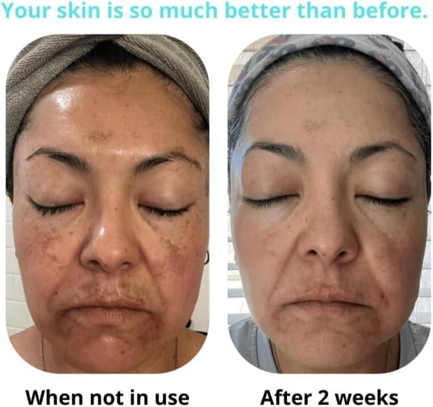 Saam renewal face cream, remove wrinkles, melasma, freckles, skin aging, dark skin 6c4e29